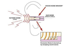 EarLock retention rings ensure consistent fit with seven-point contact.