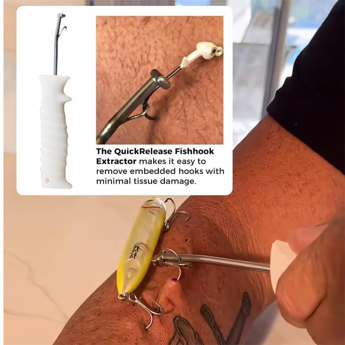 Stainless steel tip and hook groove design